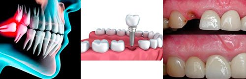 Tratamiento de ortodoncia y ortopedia